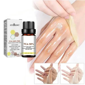 Acid Peeling Serum Chemical Exfoliant Peel for remove Face Dark Skin Spots Whiten Lighten Melanin Peeling Solution Skin Peel
