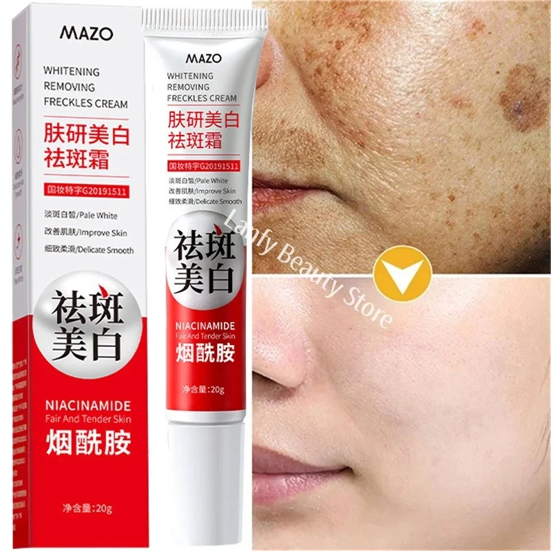 Powerful Spot-Removing Whiten Cream Brighten Skin Fast Eliminates Melanin Pigmentation Melasma Dark Spots Korean Skin Care