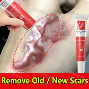 Effective Scar Removal Cream Treatment Stretch Marks Burn Surgical Scar Ointment Acne Spot Repair Gel Whitening Smooth Skin Care