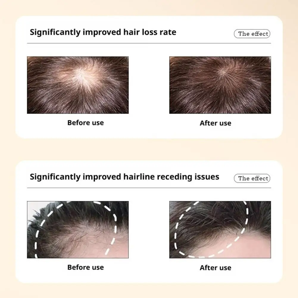 kf-S93f551e0216048e1974374f36f1b7647P