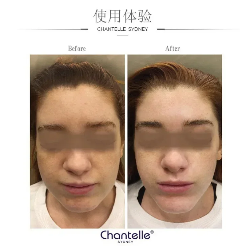 kf-Sa75e19dad94b435cb0b2ed8fbab0c0c9U