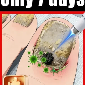 The fifth generation of champagne-colored nail laser penʜᴇʟᴘs ʏᴏᴜ sᴀʏ ɢᴏᴏᴅʙʏᴇ ᴛᴏ ᴏɴʏᴄʜᴏᴍʏᴄᴏsɪs. Tᴇᴄʜɴᴏʟᴏɢʏ ᴄʜᴀɴɢᴇs ʏᴏᴜʀ ʟɪharᴇ。