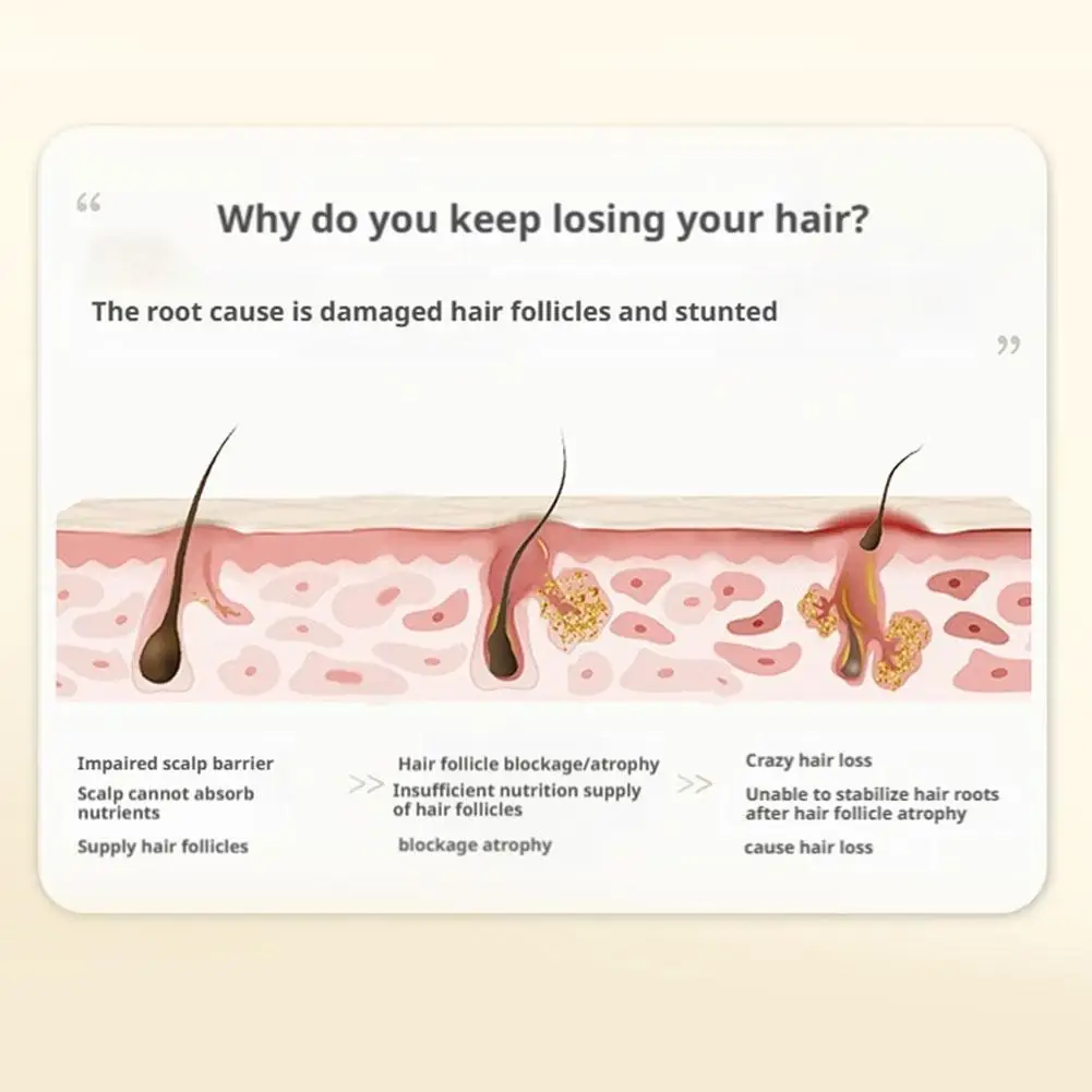 kf-Sd45e614d3cd440dfb91b9bae9fe64513P