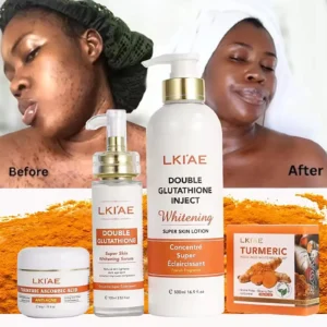 AILKE Whitening Acne Removal Skin Care Set, With Glutathione, Vitamin C, Aloe Vera, Moisturizes, Evens Skin Tone