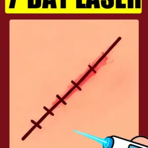 Second generation laser pens to solve your scar problems and keep your skin healthy