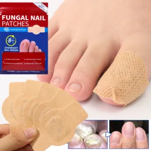 21pcs Waterproof Nail Fungus Patch Ingrown Toenail Correction Sticker Damaged Gray Nail Repair Care Feet Tools